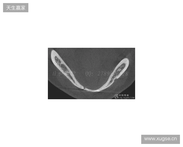 韦林顿确诊上唇部贯通伤；11、21牙半脱位；上颌前牙区牙槽骨骨折
